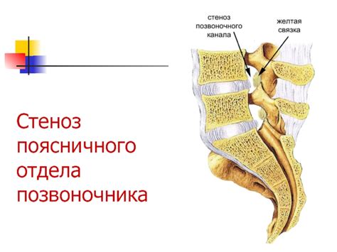 Боли в спине презентация, доклад
