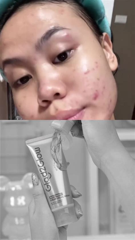 facial wash niacinamide  kulit cerah gg tiktok
