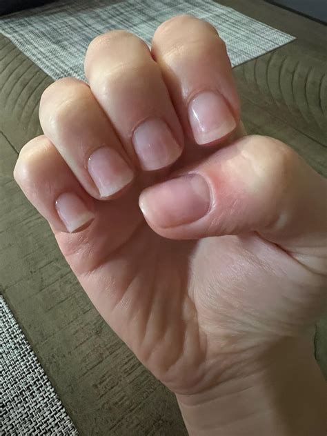 Why do my nails grow outwards like this? How to fix? Filing? : r/Nails