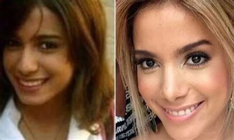 Anitta's surgery transformation: see before and after photos | HELLO!
