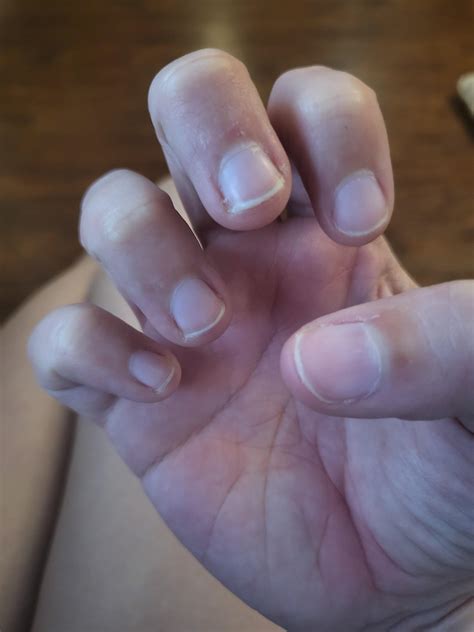 No Biting! 8