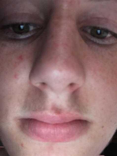 My nuts itch the sequal : r/gromek