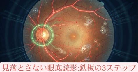 もう見落とさない！眼底読影 鉄板の3ステップ｜れちノート