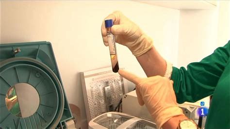 Comando Actualidad: La eterna juventud - El "lifting de los vampiros