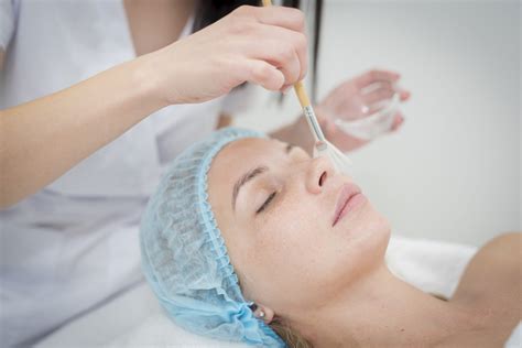 Chemical Peels for Acne Scars: Types, Benefits & Results
