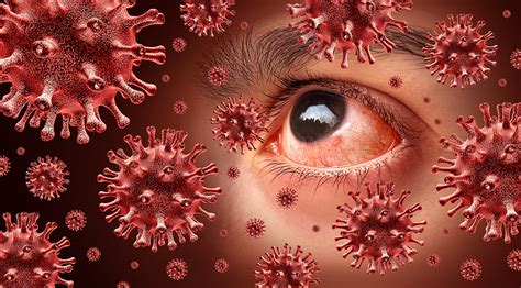 Ocular Surface Disease | Vision For Life