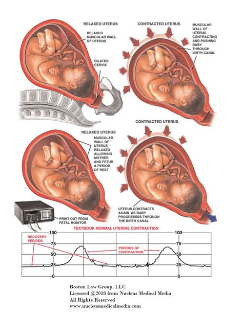 pregnancy contraction chart timing contractions yefw