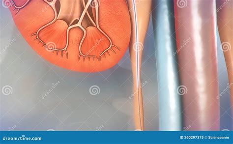 ureteral stent procedure  medical stock illustration illustration