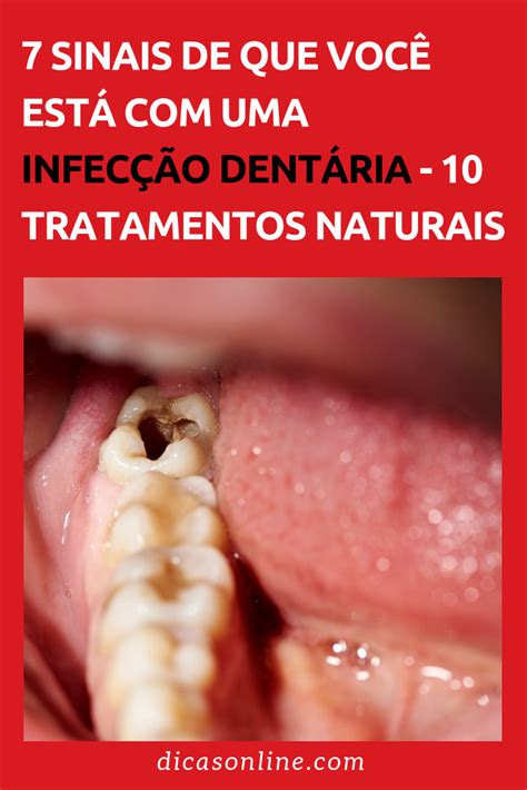 Sintomas De Infecção No Osso Do Dente - Qual É A Infecção Dentária? _ O que é e quais as causas mais comuns da ...