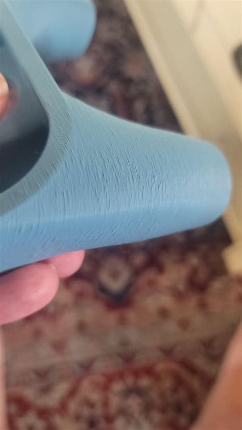 loose voluminous stool eating barely  fat