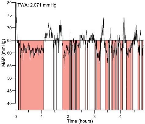 Incidence, Severity and Clinical Factors Associated with Hypotension in