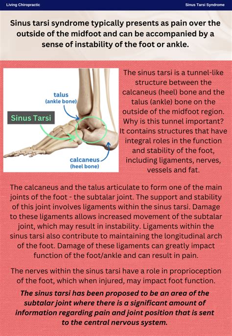 Sinus Tarsi Syndrome - Living Chiropractic