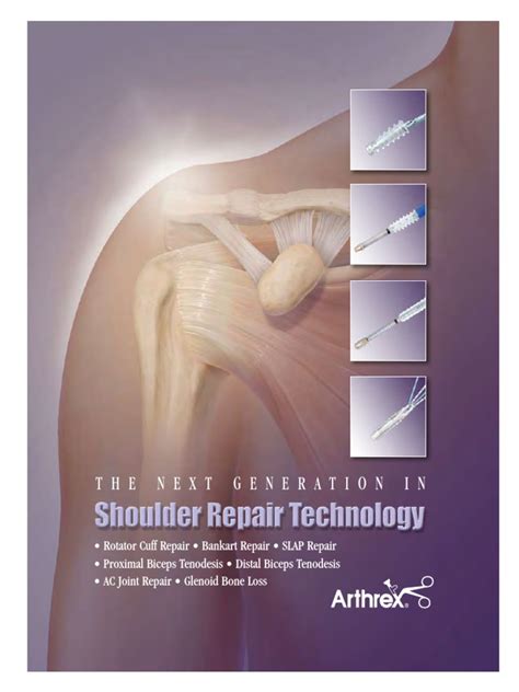 Arthrex Shoulder Repair Tehnology | PDF | Surgical Suture | Shoulder