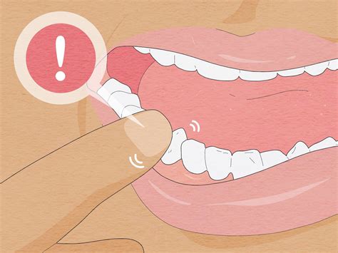 how to pull a tooth at home that isn't loose