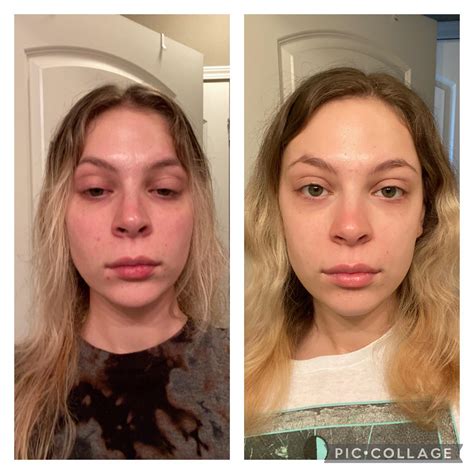 Before And After Cigarettes