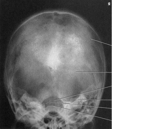 radiographs radiology study aids