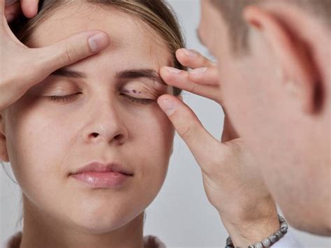 Why is My Top Eyelid Drooping? - Consultants in Ophthalmic and Facial ...
