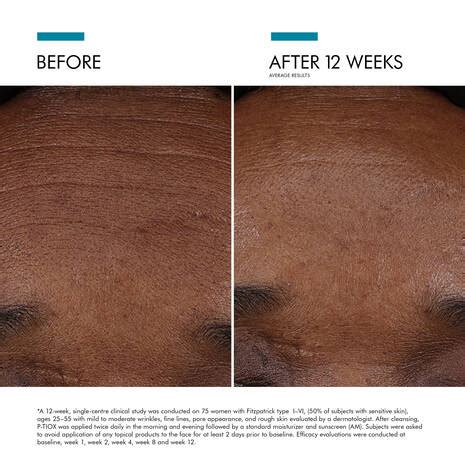 P-TIOX Anti-Wrinkle Serum - Fine Lines - SkinCeuticals CA