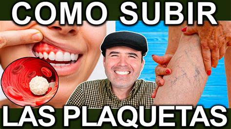O Que Causa Plaquetas Altas - Plaquetas Altas O Bajas: Causas Y Cómo Identificarlas – EOYS