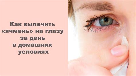 Как вылечить ячмень на глазу за день в домашних условиях - YouTube