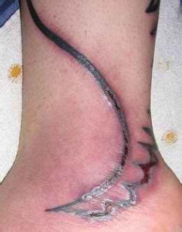 Tattoo Infection: Signs, Risks, and Prevention - Hunter Games Magazine