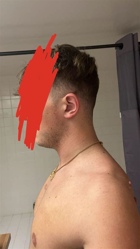 Do I have forward neck posture : r/PostureTipsGuide