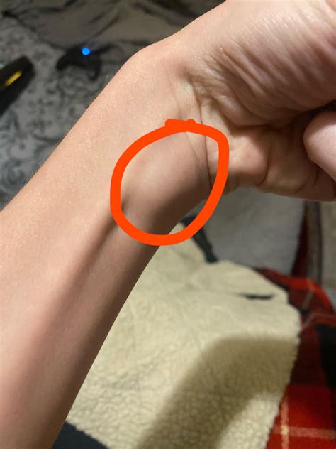 small lump on wrist not quite sure i should be concerned : r/medical_advice