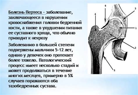 Заболевания и травмы вертлужной впадины: классификация, симптомы ...