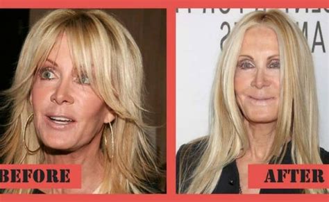 plastic surgery  wrong pictures     feel