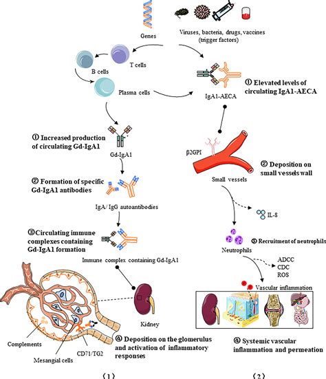 Frontiers | IgA vasculitis update: Epidemiology, pathogenesis, and