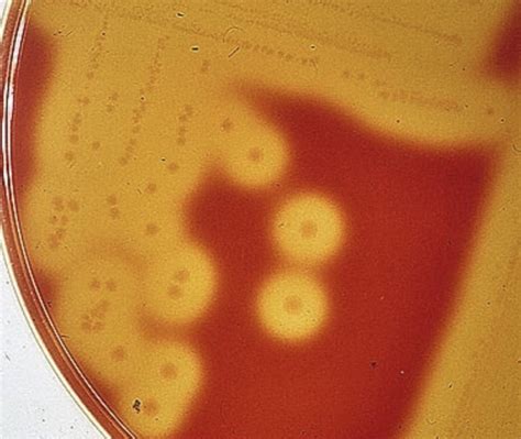 solved  type  hemolysis   cheggcom