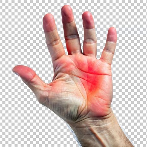 Premium PSD | Rheumatoid arthritis gouty arthritis on transparent