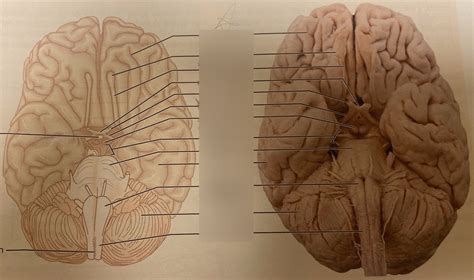ventral aspect   human brain diagram quizlet