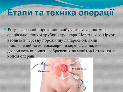 Герніопластика - презентація з медицини