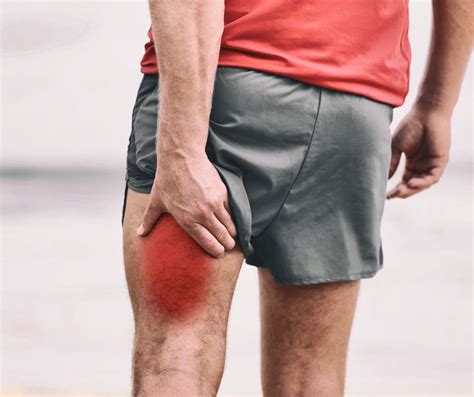 Hamstring Pain Behind Knee Symptoms at Bernice Abram blog