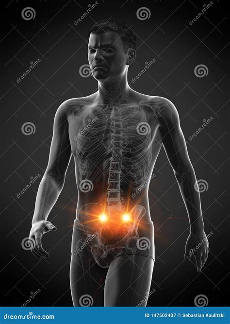 Pain in the Sacroiliac Joint Stock Illustration - Illustration of bones