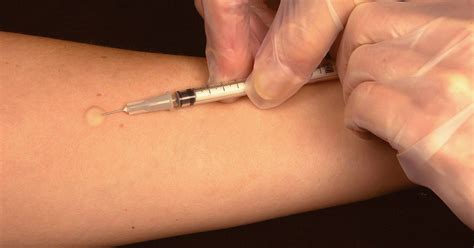 tuberculosis tests tb tests shoebill  traveller shoebill health