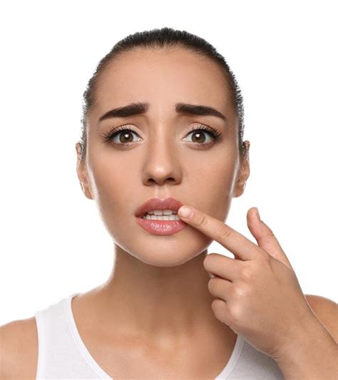 white spots   lips lipstutorialorg