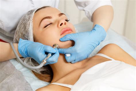 How Microdermabrasion Improves Your Skin | Annandale VA Med Spa