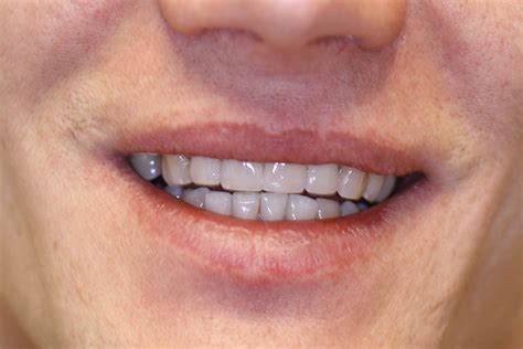 priit  dental beauty