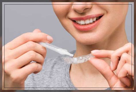 how long to keep teeth whitening gel on
