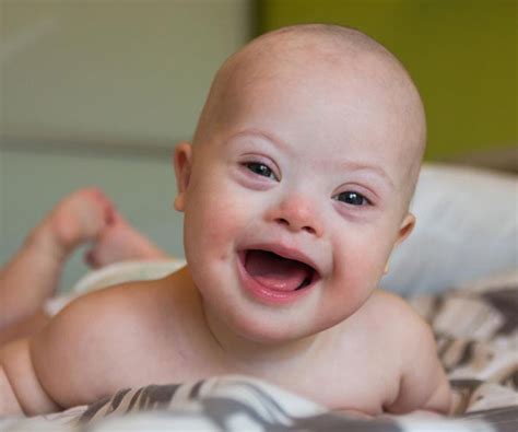 stem cell treatment   syndrome  delhi india therapy center