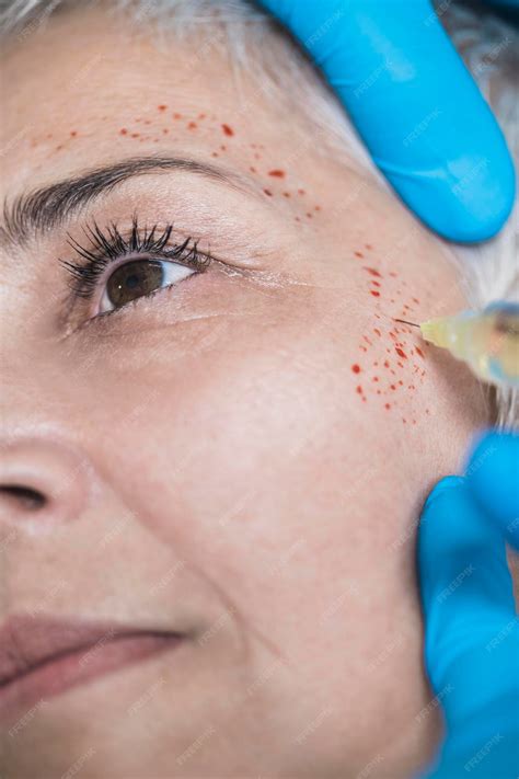 Premium Photo | Prp face injecting treatment cosmetic antiaging