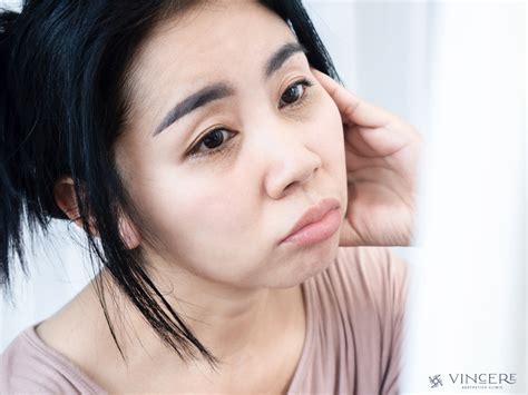 dark eye circle treatments singapore  aesthetics clinic singapore