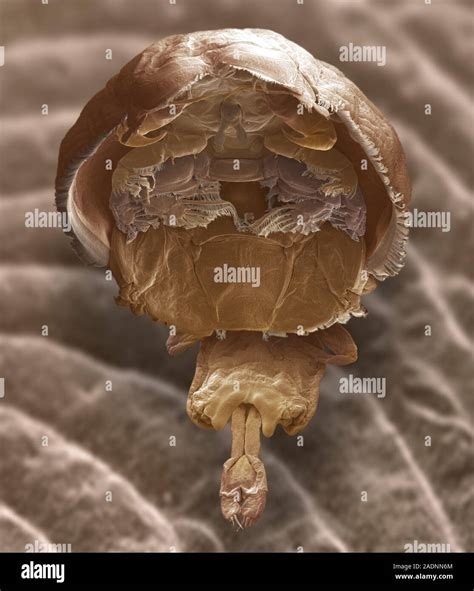 salmon louse coloured scanning electron micrograph sem
