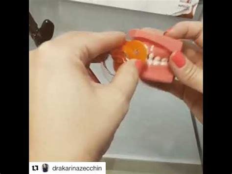 Dente De Crianca Que Chupa Bico - Como ficam os dentes da criança que chupa chupeta - YouTube