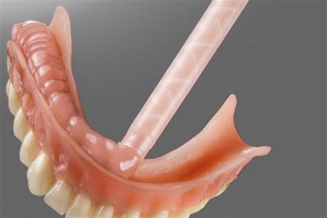 soft liners modern denture clinic