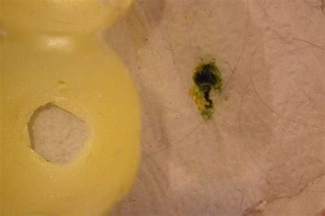 Baby chick Green poop | BackYard Chickens - Learn How to Raise Chickens