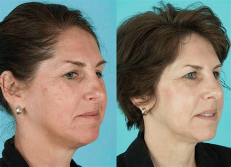 COASTAL FACIAL PLASTIC SURGERY & AESTHETICS | Reconstructive Plastic ...