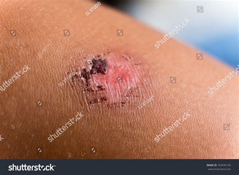 12,677 imágenes de Crust skin - Imágenes, fotos y vectores de stock ...
